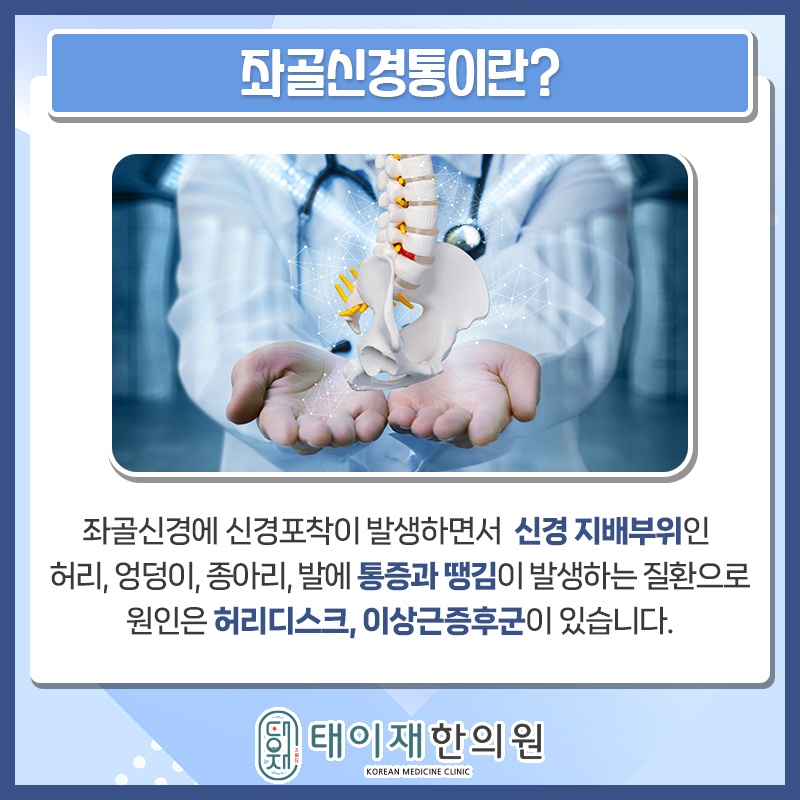 다리로 이어지는 통증, 좌골신경통과 요통의 차이