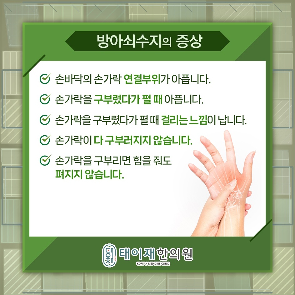 손을 자주 세게 쥐는 습관과 방아쇠수지의 연관성