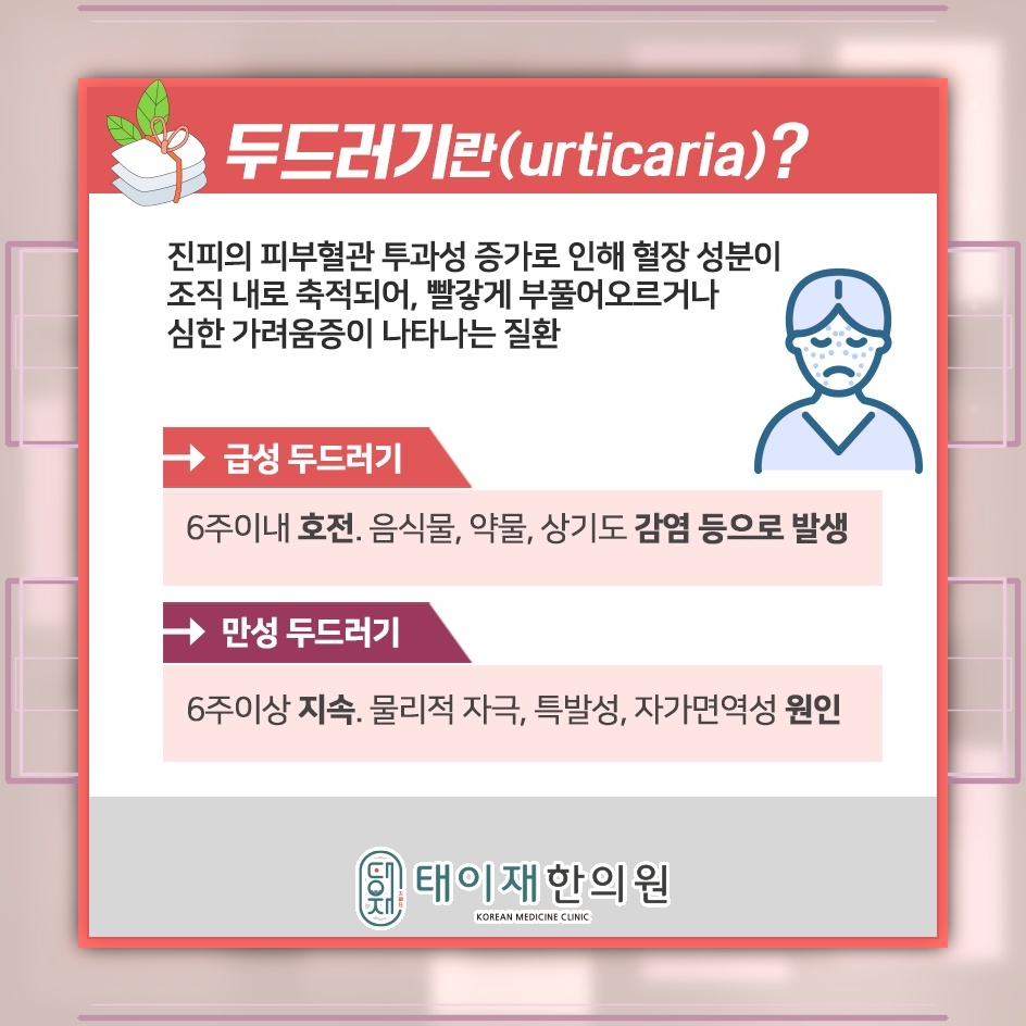 뚜렷한 원인 없이 이어지는 만성 두드러기 관리