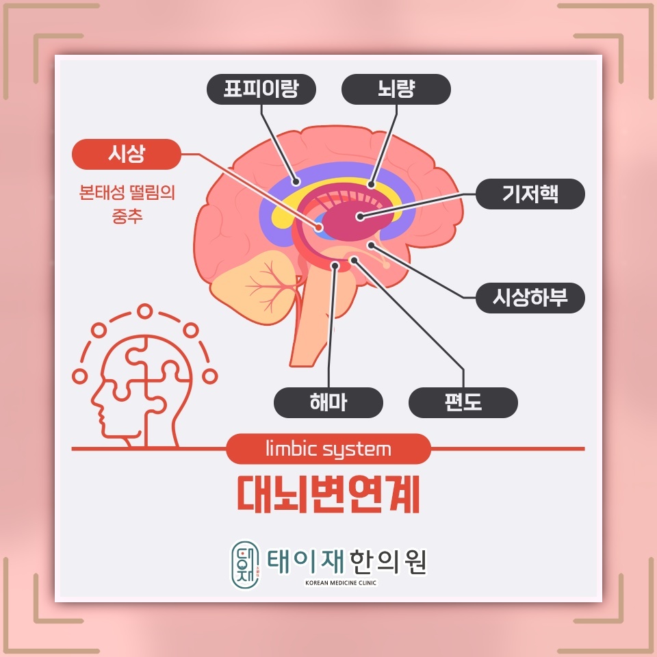 본태성떨림, 손떨림의 빈도와 강도가 달라질 때