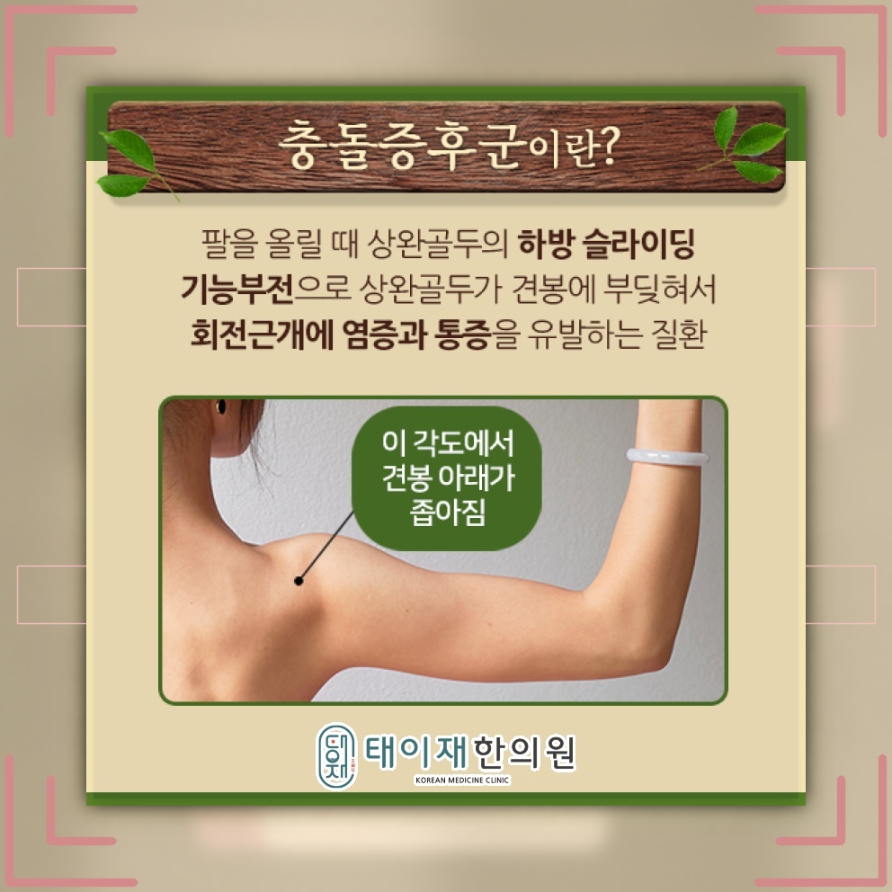 팔을 올릴 때 어깨가 아픈 충돌증후군의 주요 신호