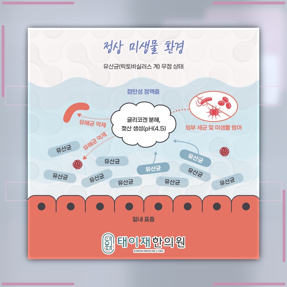 세균성 질염을 의심할 수 있는 증상과 발생 요인