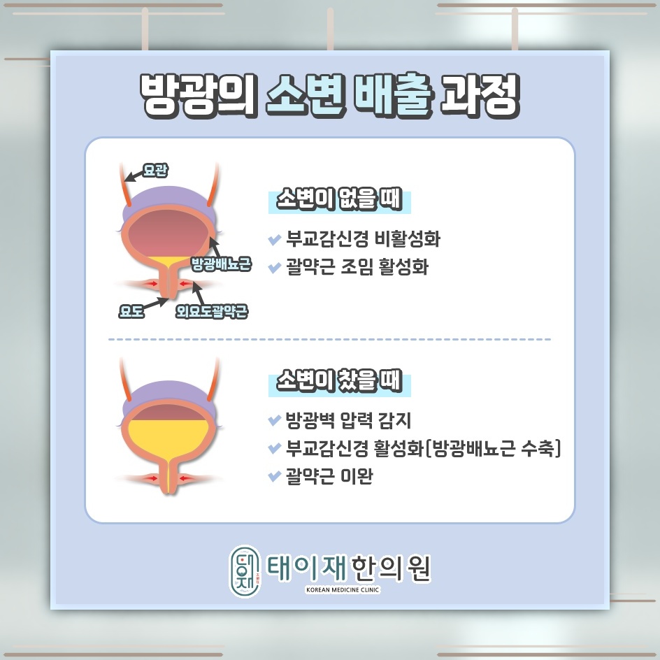 배뇨 조절이 어려운 요실금, 원인별 유형 살펴보기