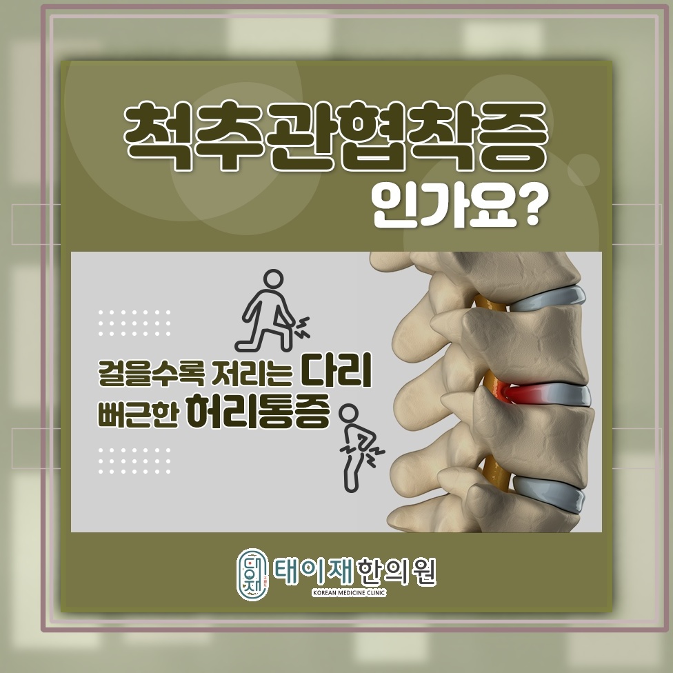 척추관협착증 통증 완화를 위한 일상 관리법