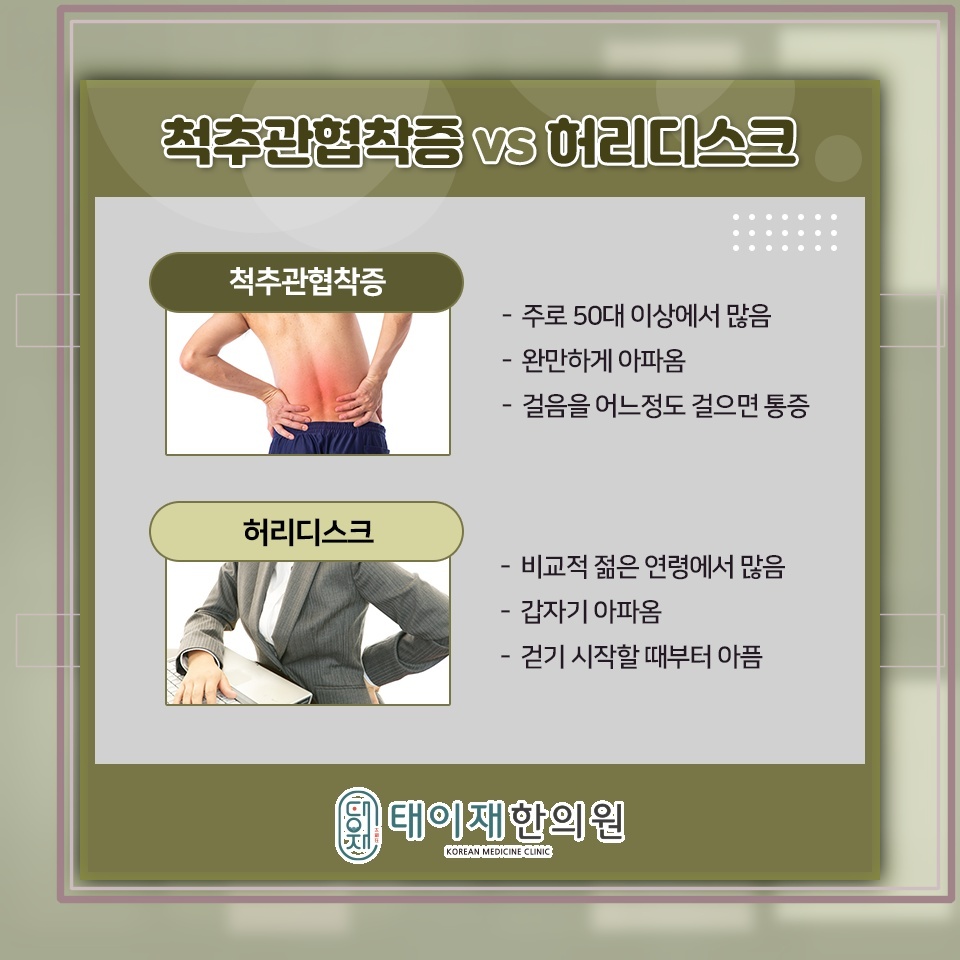 척추관협착증 통증 완화를 위한 일상 관리법