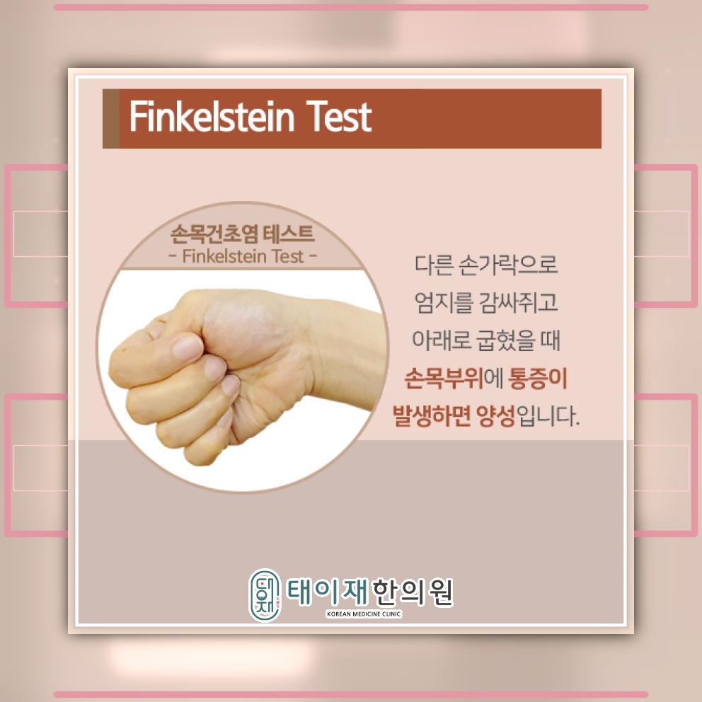 붓기와 열감으로 알아보는 손목건초염의 주요 신호