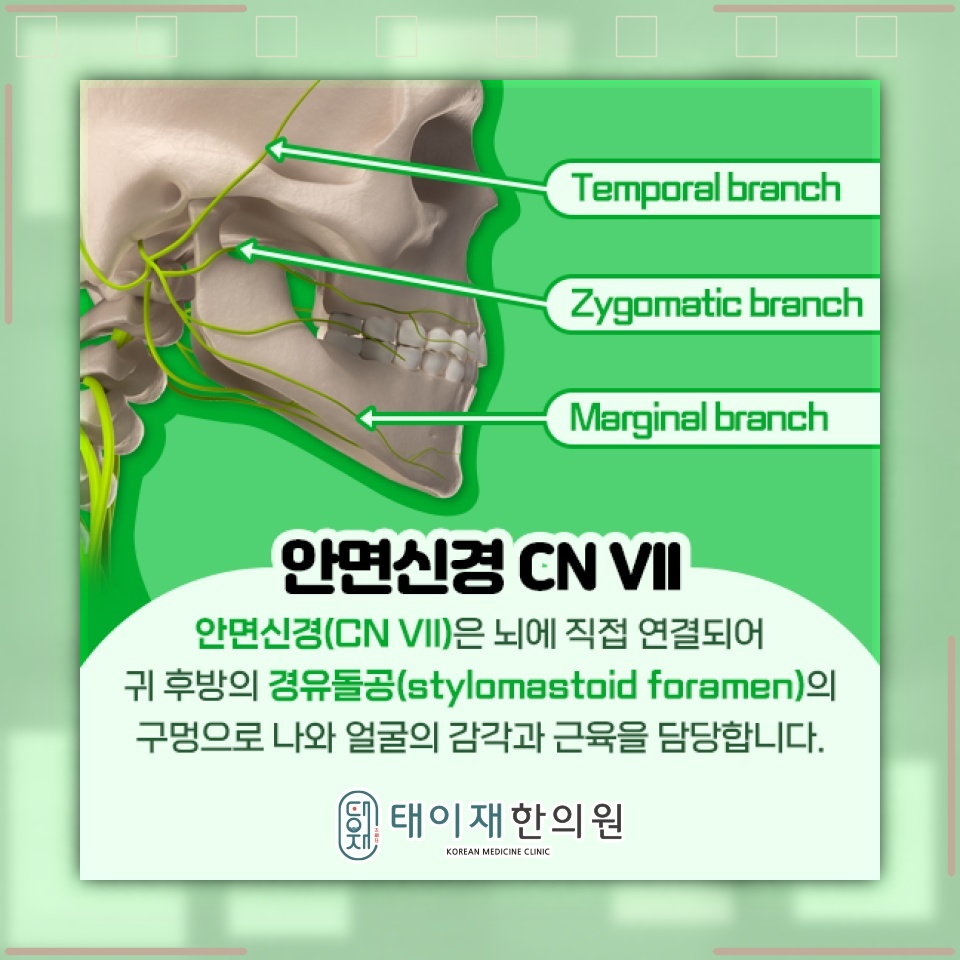 안면신경마비로 나타나는 얼굴 비대칭과 표정 변화