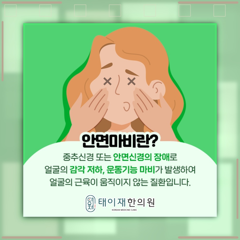 안면신경마비로 나타나는 얼굴 비대칭과 표정 변화